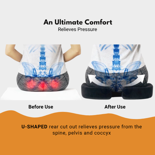 MyErgonomy Orthopaedic Coccyx Seat Cushion